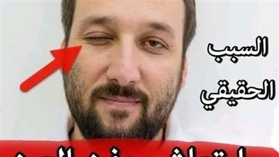 تعرف على السبب الحقيقي لارتعاس جفن العين 