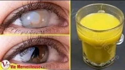 سبحان الله وصفه طبيعية جعلها الله علاج لضعف البصر 