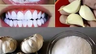 وصفه لعلاج الأسنان في البيت